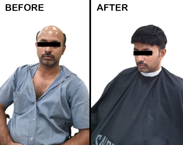 Hair Extension